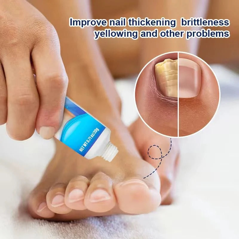 Sumifun - Nail Fungus Treatment