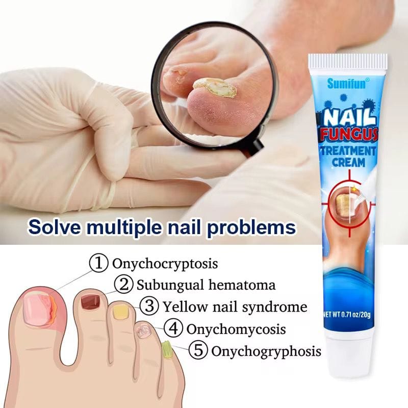 Sumifun - Nail Fungus Treatment