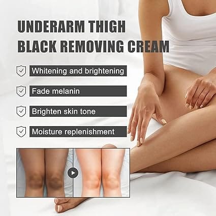 Dark Spot Remover Cream