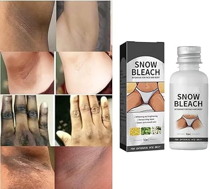 Dark Spot Remover Cream