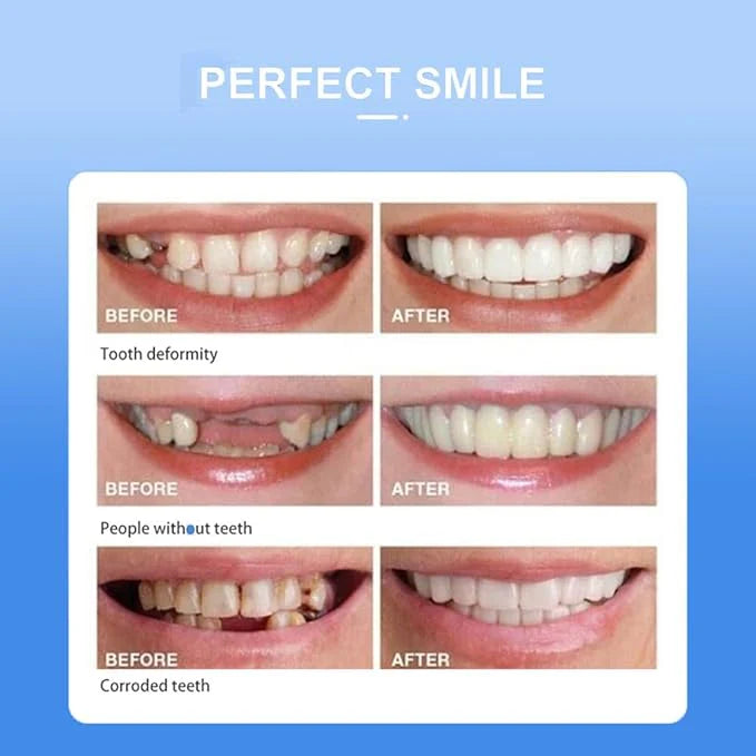 Snap On Smile - Snap On Smile